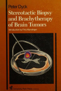 STEREOTACTIC BIOPSY AND BRACHYTHERAPY OF BRAIN TUMORS